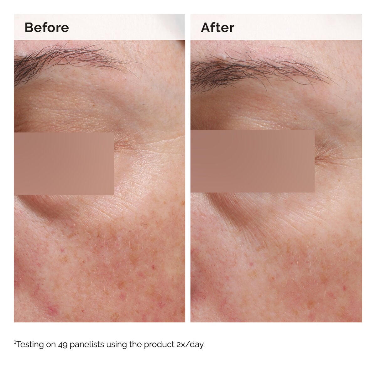 niacinamide-5-face-and-body-emulsion-v7 2024-08-23-ORD-Nia-5pct-Face-Body-B-A-Elasticity-Global-02-1x1.jpg