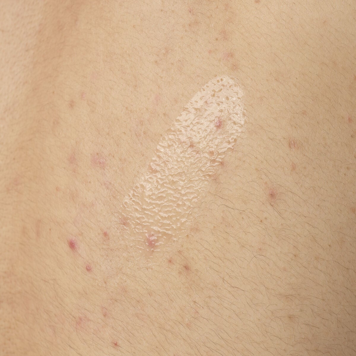 salicylic-acid-0-5-body-serum-j3 ORD-salicylic-acid-05-body-240ml-application.jpg