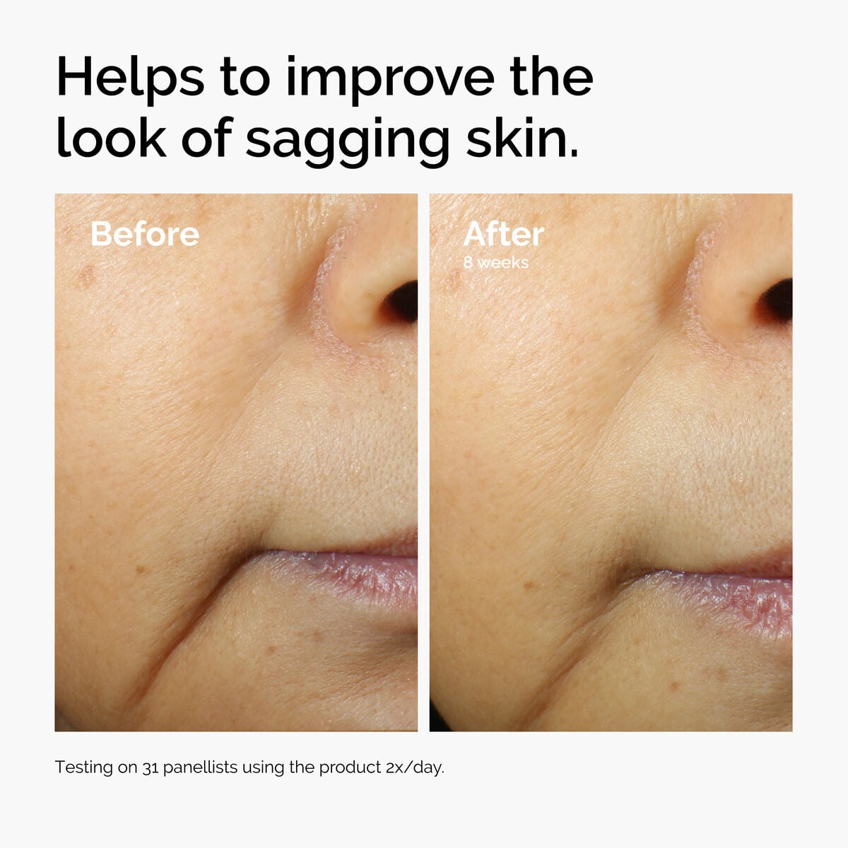 caffeine-3-escin-1-face-serum-j0 ord-caffeine-3pct-escin-1pct-face-serum-before-after-sagging.jpg