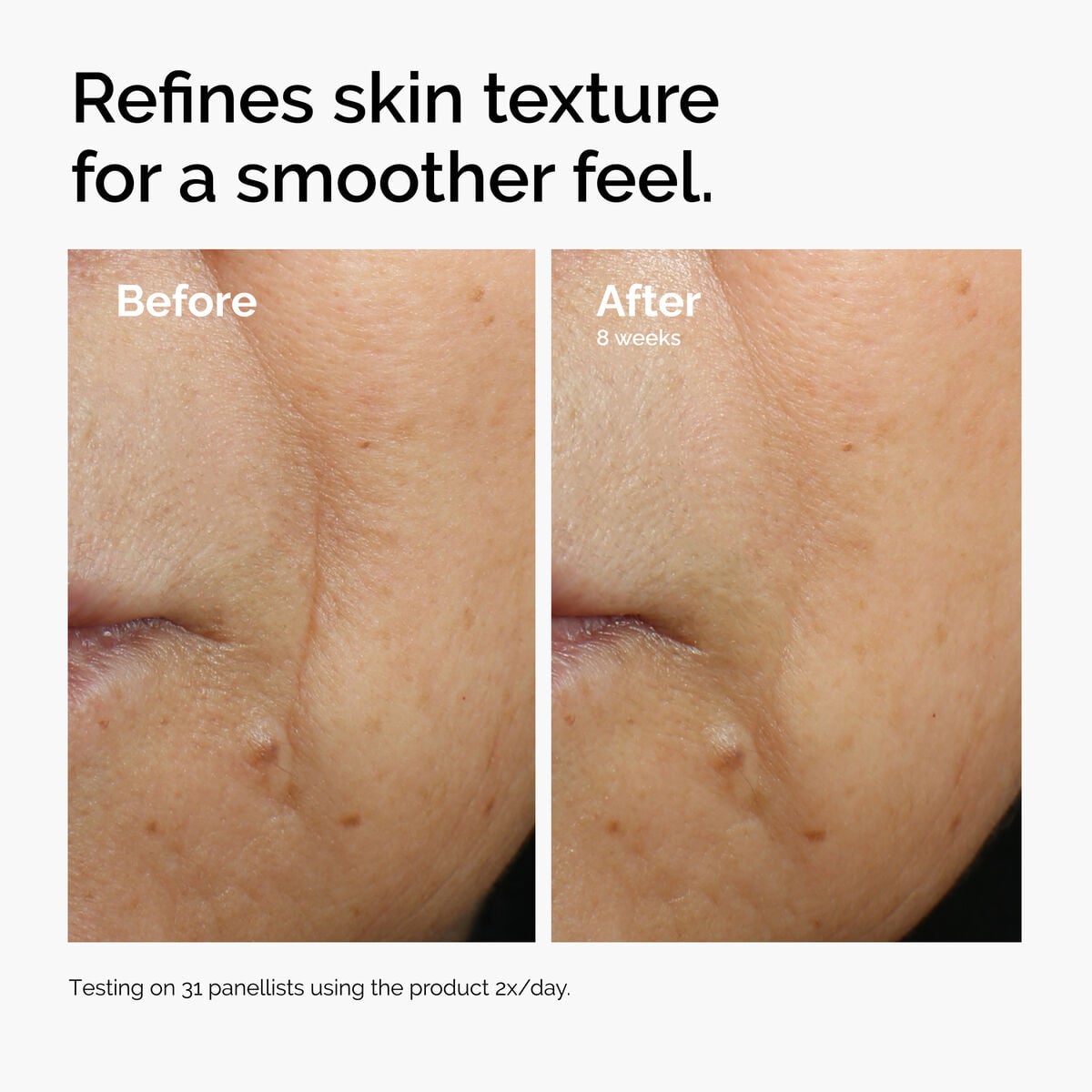 caffeine-3-escin-1-face-serum-j0 ord-caffeine-3pct-escin-1pct-face-serum-before-after-texture.jpg