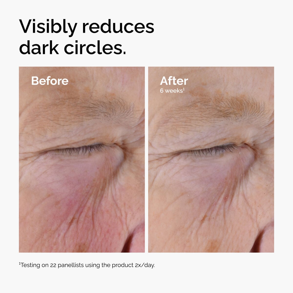 caffeine-solution-5-egcg-eye-serum-v3 ord-caffeine-solution-egcg-dark-circles-before-after.jpg