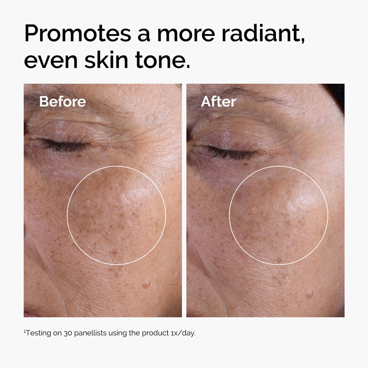 glycolic-acid-7-exfoliating-toner-g2 ord-glycolic-before-after-radiance.jpg