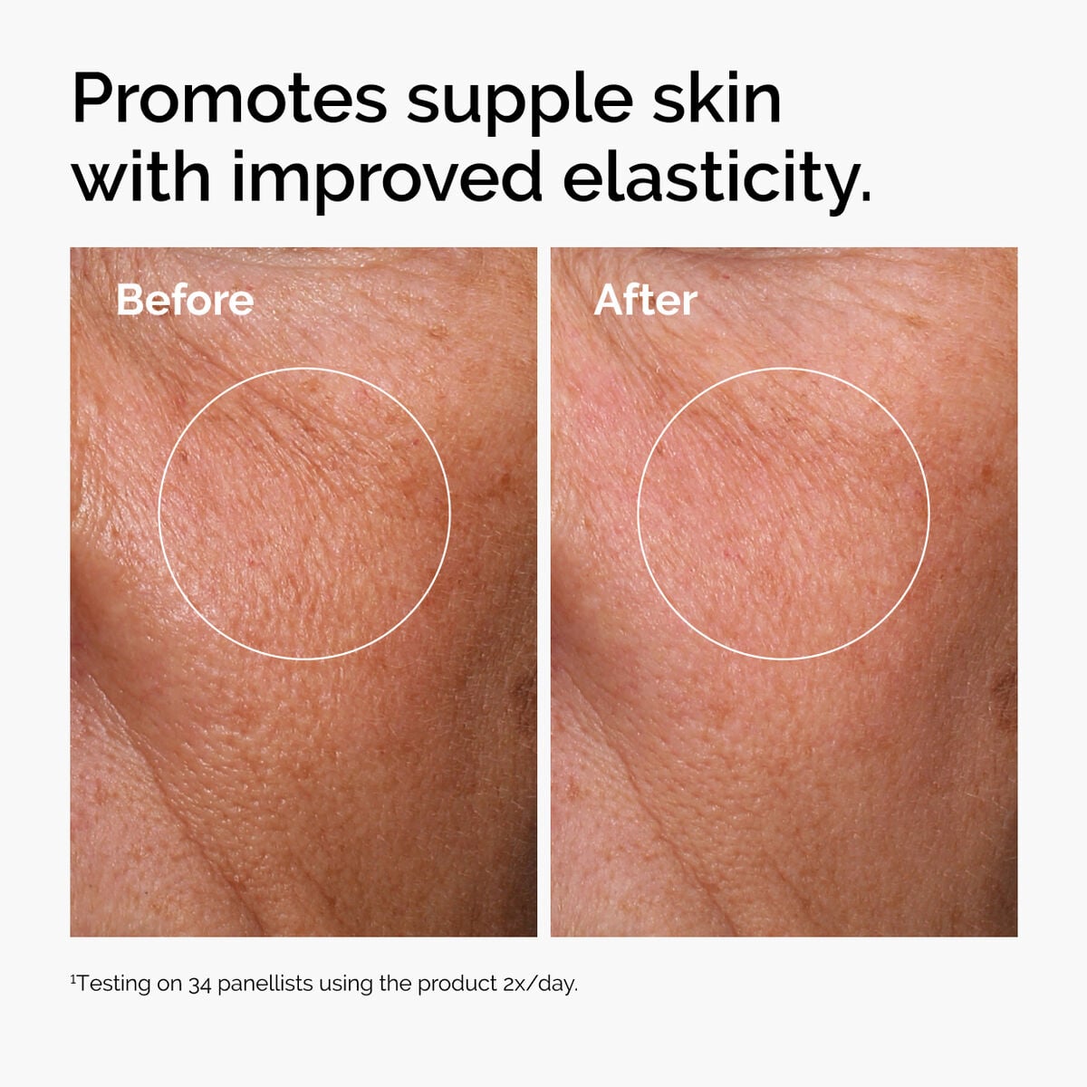 hyaluronic-acid-2-b5-with-ceramides-k0 ord-hyaluronic-acid-2pct-b5-hydrating-serum-before-after-elasticity.jpg