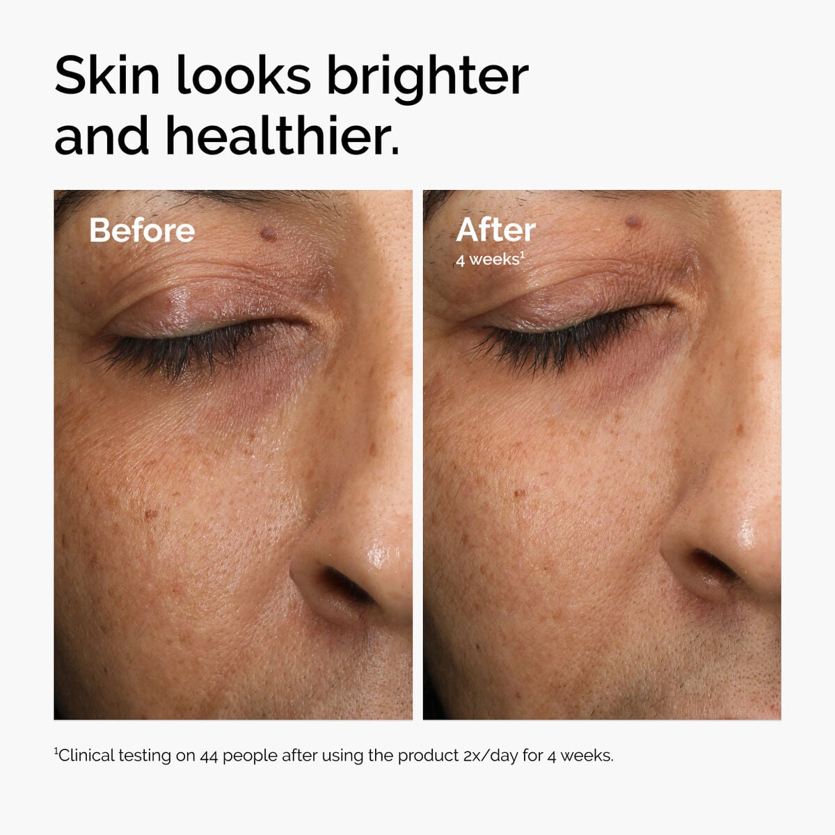 multi-antioxidant-radiance-serum-k7 ord-mars-before-after-healthy.jpg