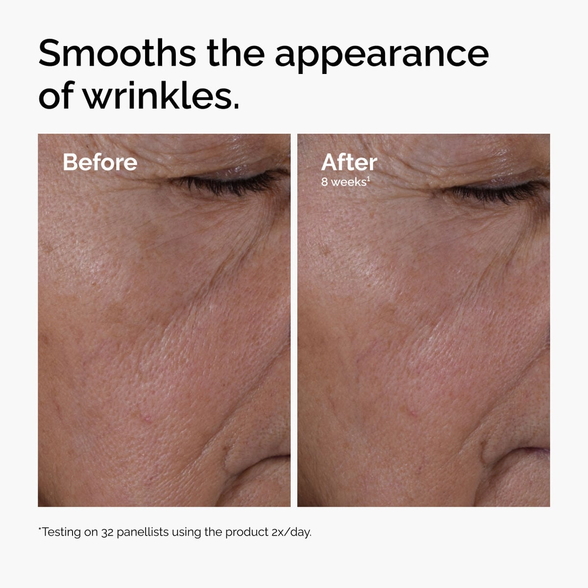 multi-peptide-ha-serum-o5 ord-multi-peptide-ha-serum-wrinkles-before-after.jpg