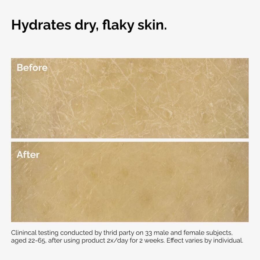 the-body-care-collection-t2 ord-natural-moisturizing-factors-inulin-body-before-after-graphic-02.jpg