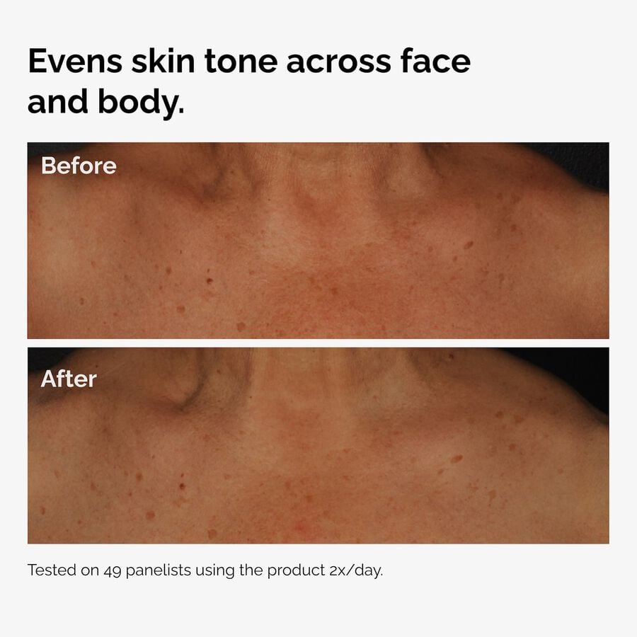 the-body-care-collection-t2 ord-niacinamide-face-body-serum-before-after-even-tone-graphic.jpg