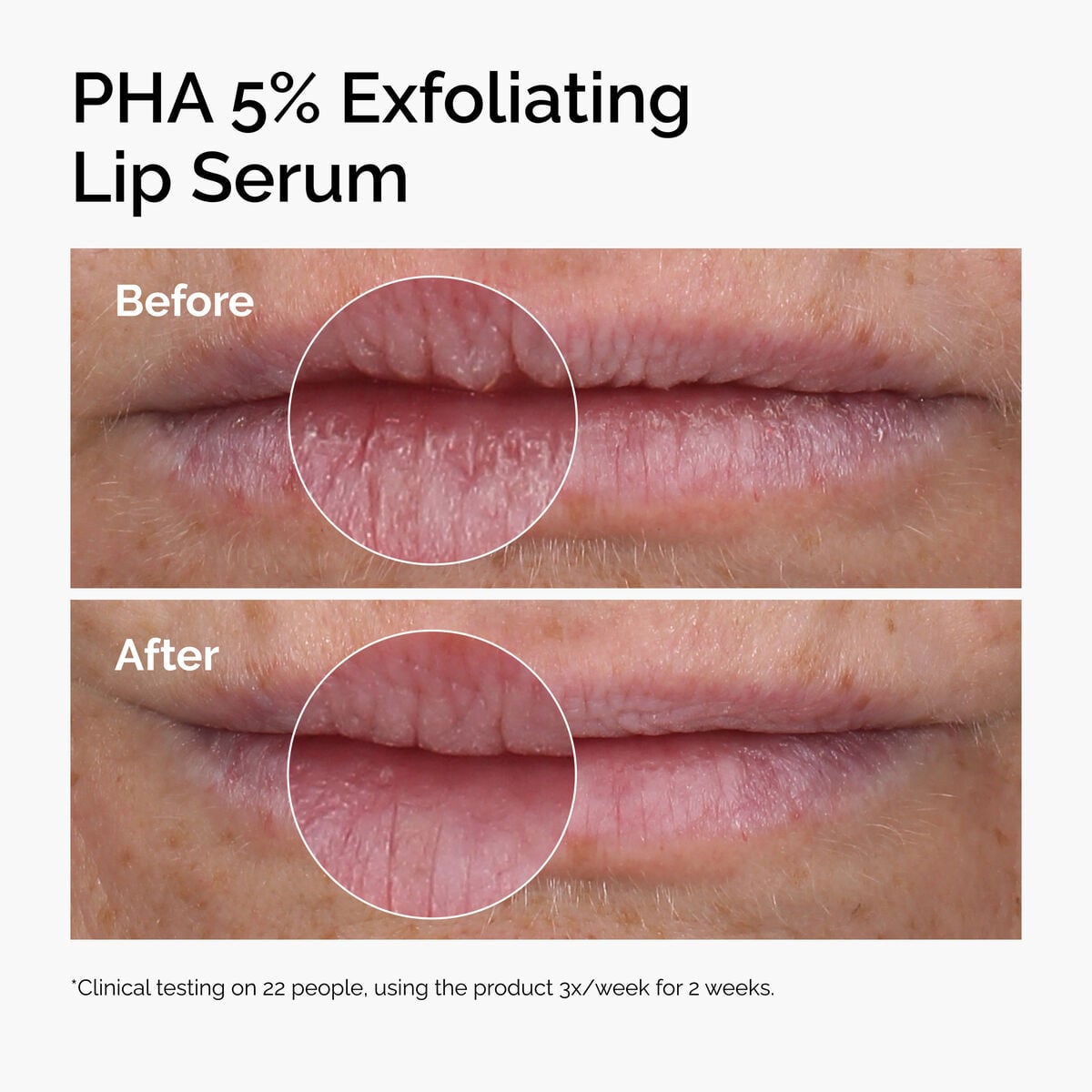 pha-5-exfoliating-lip-serum-k1 ord-pha-5pct-lip-exfoliating-serum-before-after.jpg