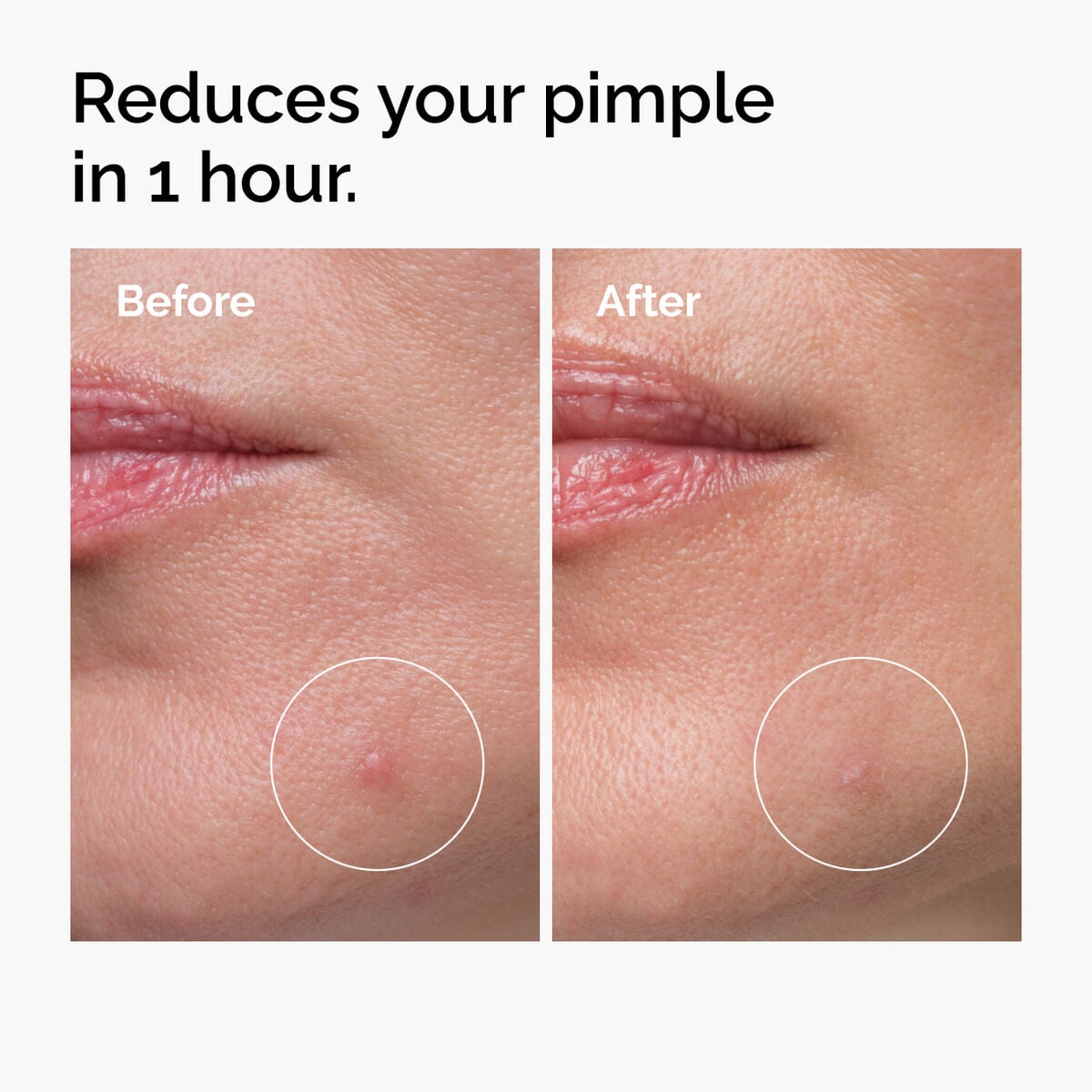 sulfur-10-powder-to-cream-concentrate-n4 ord-sulfur-10pct-powder-to-cream-concentrate-before-after-NA.jpg